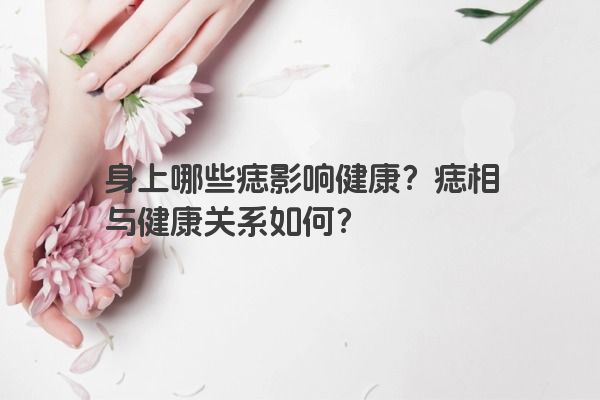 身上哪些痣影响健康？痣相与健康关系如何？