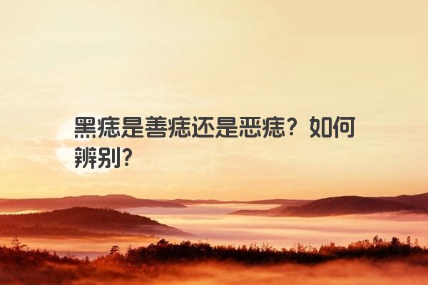黑痣是善痣还是恶痣？如何辨别？